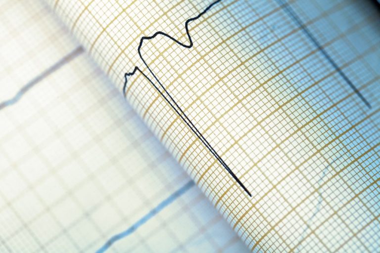 Ταχυκαρδία: Πότε είναι φυσιολογική και πότε χρειάζεται έλεγχο